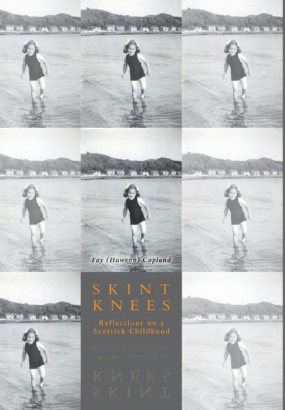 Skint Knees: Reflections On A Scottish Childhood