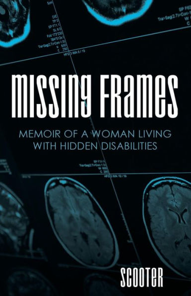 Missing Frames: Memoir Of A Woman Living With Hidden Disabilities