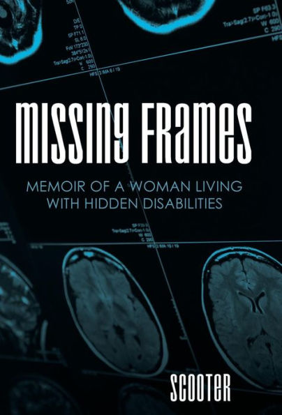 Missing Frames: Memoir Of A Woman Living With Hidden Disabilities