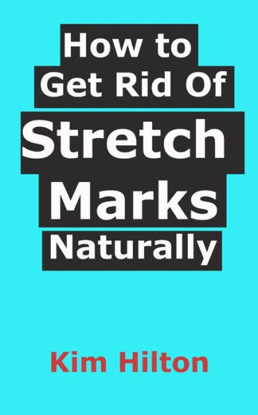 How To Get Rid Of Stretch Marks Naturally