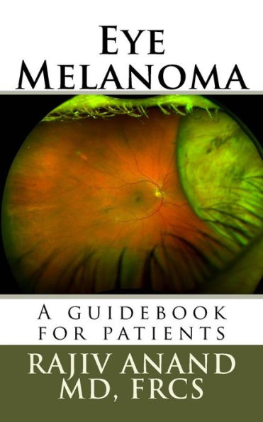 Eye Melanoma: A Manual For Patients