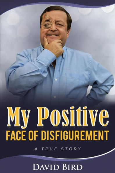 My Positive Face Of Disfigurement:: A True Story