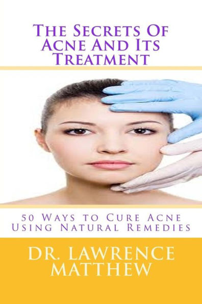 The Secrets Of Acne And Its Treatment: 50 Ways To Cure Acne Using Natural Remedies