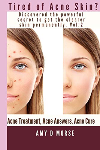 Tired Of Acne Skin? Discover The Powerful Secrets To Get Clearer Skin Permanently (Volume)