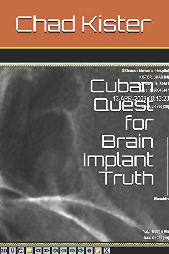 Cuban Quest for Brain Implant Truth (Brain Implant Truth Quests)