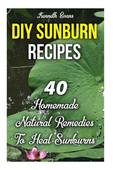 DIY Sunburn Recipes: 40 Homemade Natural Remedies To Heal Sunburns