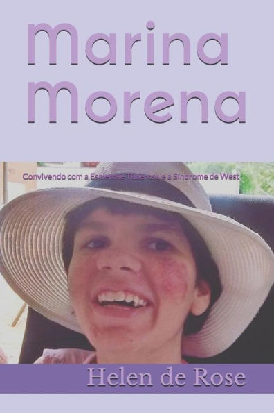 Marina Morena : Convivendo Com A Esclerose Tuberosa E A Síndrome De West