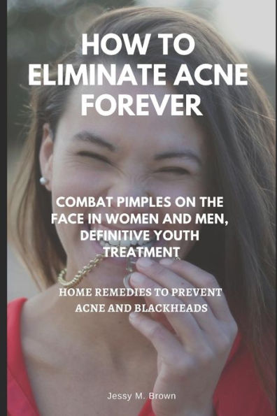 HOW TO ELIMINATE ACNE FOREVER : COMBAT PIMPLES ON THE FACE IN WOMEN AND MEN, DEFINITIVE JUVENILE TREATMENT, HOME REMEDIES TO PREVENT ACNE AND BLACKHEADS