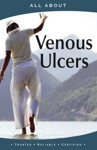 All About Managing Venous Ulcers (All About Books)