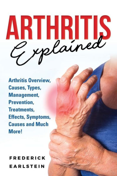 Arthritis Explained: Arthritis Overview, Causes, Types, Management, Prevention, Treatments, Effects, Symptoms, Causes and Much More!