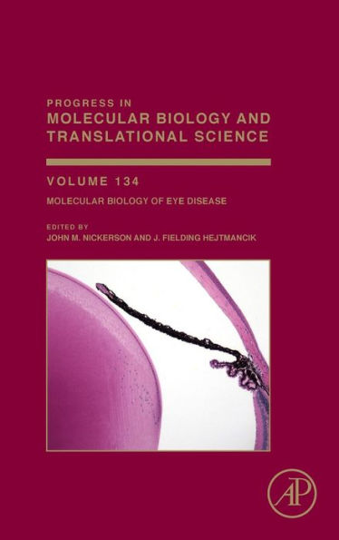 Molecular Biology Of Eye Disease (Volume 134) (Progress In Molecular Biology And Translational Science, Volume 134)
