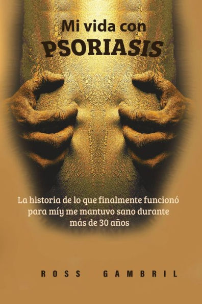 Mi Vida Con Psoriasis: La Historia De Lo Que Finalmente Funcionó Para Mí Y Me Mantuvo Claro Durante Más De 30 Años (Spanish Edition)