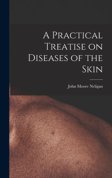 A Practical Treatise On Diseases Of The Skin