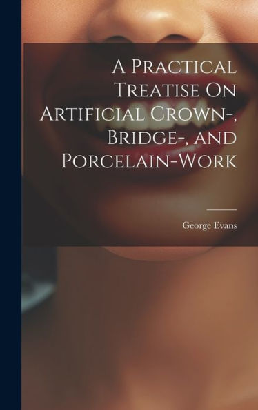 A Practical Treatise On Artificial Crown-, Bridge-, And Porcelain-Work - 9781020275838