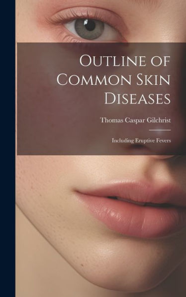 Outline Of Common Skin Diseases: Including Eruptive Fevers - 9781020324918