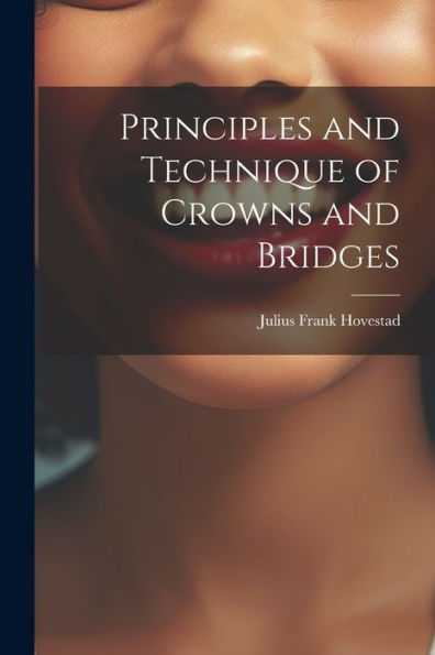 Principles And Technique Of Crowns And Bridges - 9781021613172