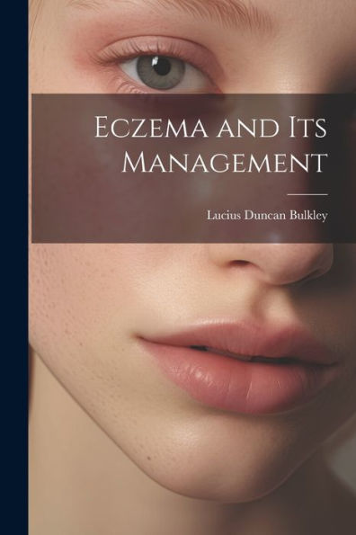 Eczema And Its Management