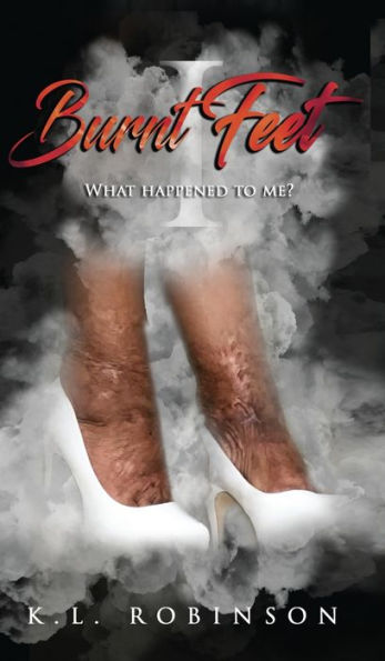 Burnt Feet: What Happened To Me?