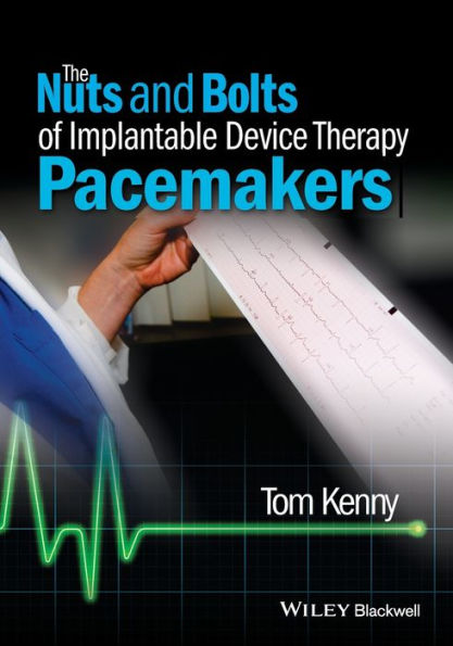 The Nuts And Bolts Of Implantable Device Therapy: Pacemakers (The Nuts And Bolts Series)