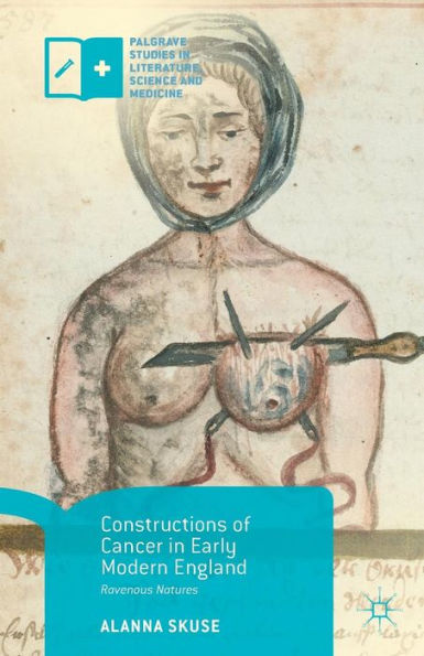 Constructions Of Cancer In Early Modern England: Ravenous Natures (Palgrave Studies In Literature, Science And Medicine) - 9781137569196
