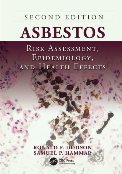Asbestos