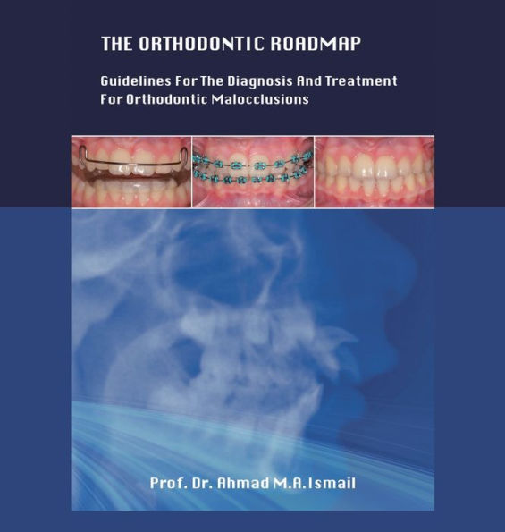 The Orthodontic Roadmap: Guidelines For The Diagnosis And Treatment Of Orthodontic Malocclusions