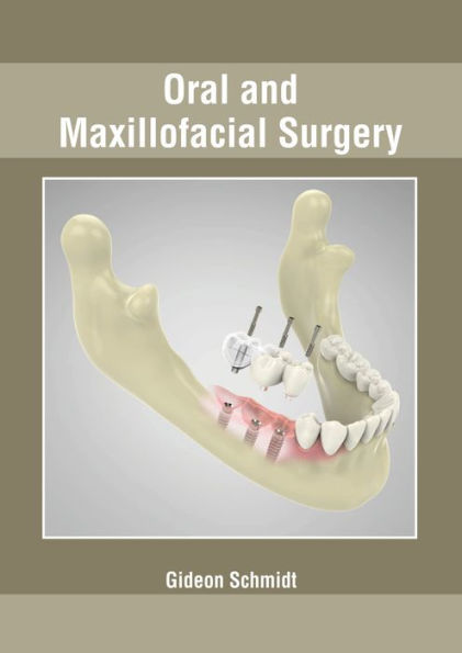 Oral And Maxillofacial Surgery