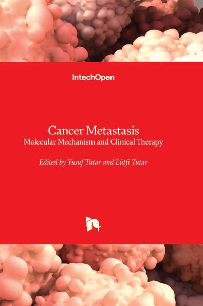 Cancer Metastasis - Molecular Mechanism And Clinical Therapy