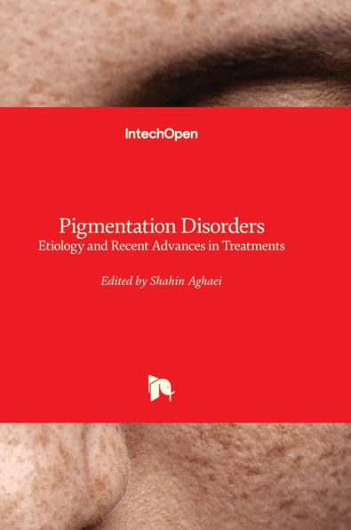Trastornos de la pigmentación: etiología y avances recientes en los tratamientos
