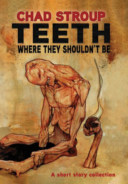 Teeth Where They Shouldn'T Be - 9781960213174