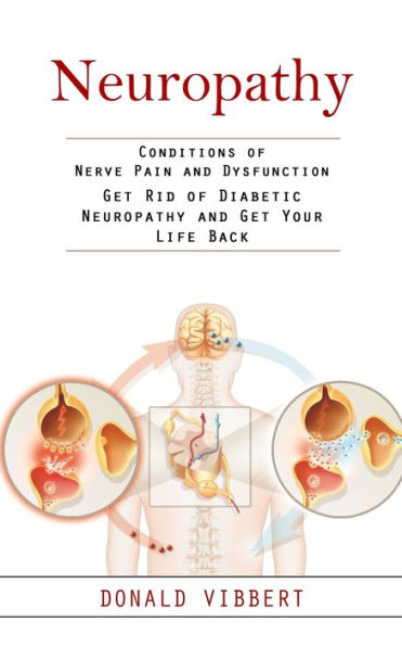Neuropatía: afecciones de dolor y disfunción de los nervios (deshágase de la neuropatía diabética y recupere su vida) - 9781998038572