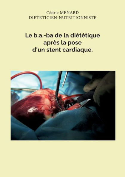 Le B.A.-Ba De La Dietetique Après La Pose D'Un Stent Cardiaque. (French Edition)