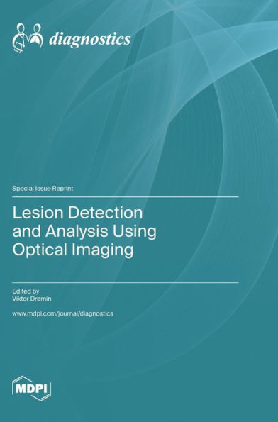 Lesion Detection And Analysis Using Optical Imaging