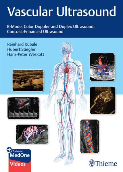 Vascular Ultrasound: B-Mode, Color Doppler And Duplex Ultrasound, Contrast-Enhanced Ultrasound - 9783132405431