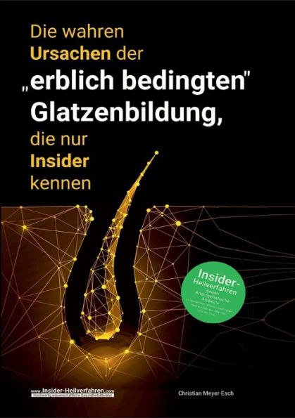 Die Wahren Ursachen Der "Erblich Bedingten" Glatzenbildung, Die Nur Insider Kennen (German Edition)